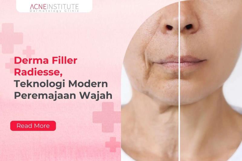 Derma Filler Radiesse, Teknologi Modern Peremajaan Wajah