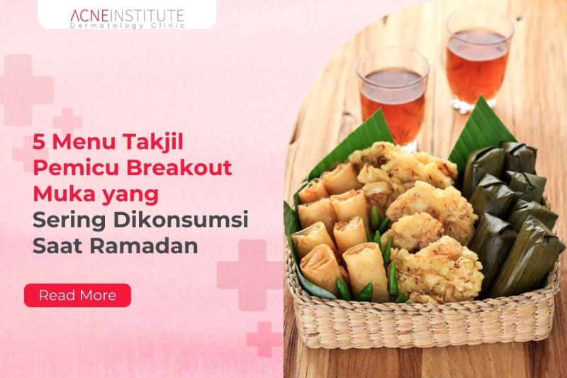 5 Menu Takjil Pemicu Breakout Muka yang Sering Dikonsumsi Saat Ramadan