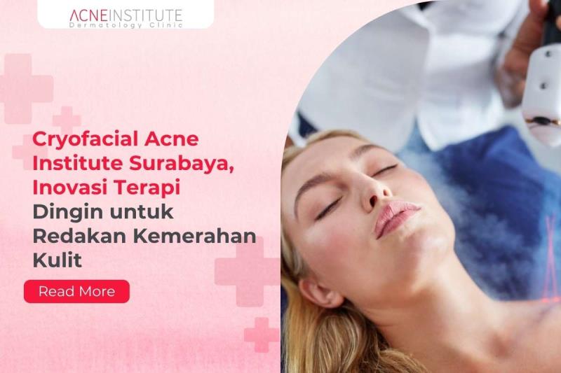 Cryofacial Acne Institute Surabaya, Inovasi Terapi Dingin untuk Redakan Kemerahan Kulit