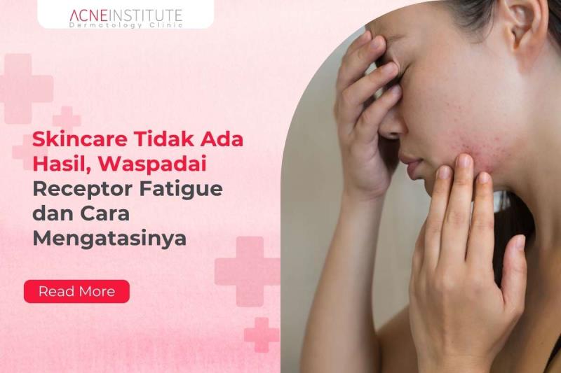 Skincare Tidak Ada Hasil, Waspadai Receptor Fatigue dan Cara Mengatasinya