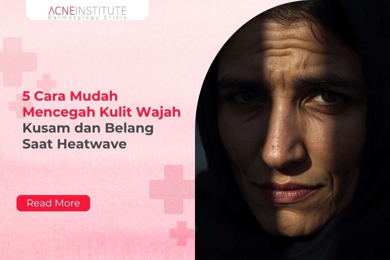 5 Cara Mudah Mencegah Kulit Wajah Kusam dan Belang Saat Heatwave