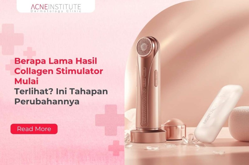 Berapa Lama Hasil Collagen Stimulator Mulai Terlihat? Ini Tahapan Perubahannya