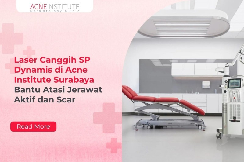Laser Canggih SP Dynamis di Acne Institute Surabaya Bantu Atasi Jerawat Aktif dan Scar