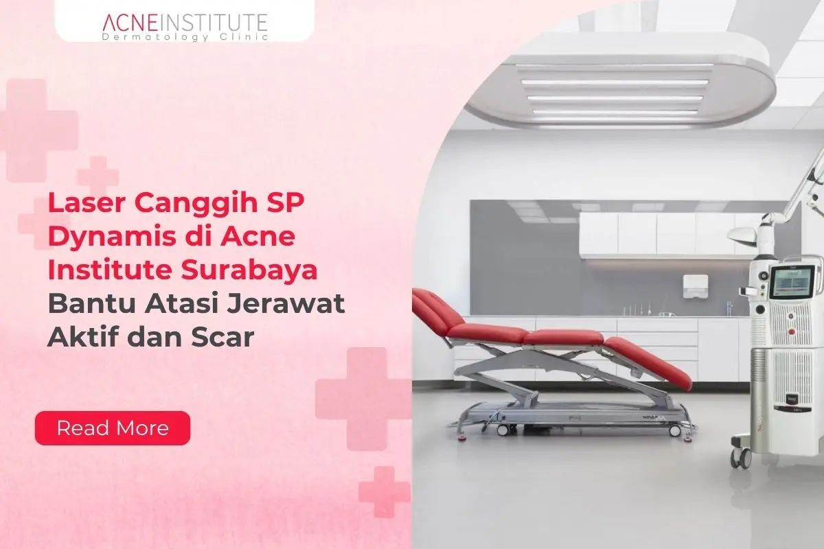 Laser Canggih SP Dynamis di Acne Institute Surabaya Bantu Atasi Jerawat Aktif dan Scar