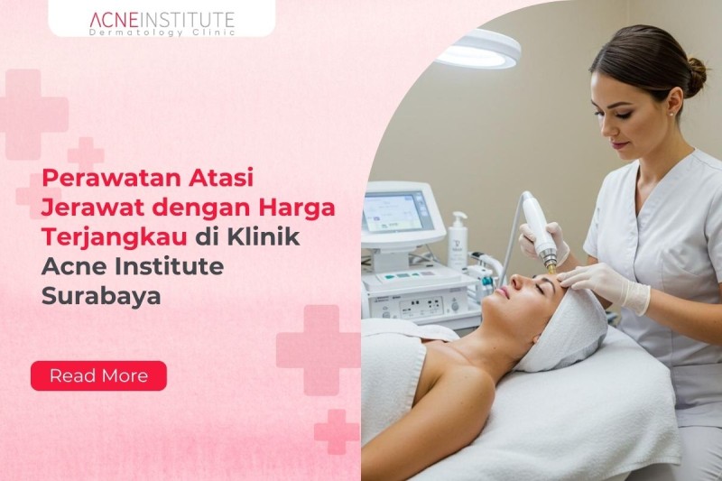Perawatan Atasi Jerawat dengan Harga Terjangkau di Klinik Acne Institute Surabaya