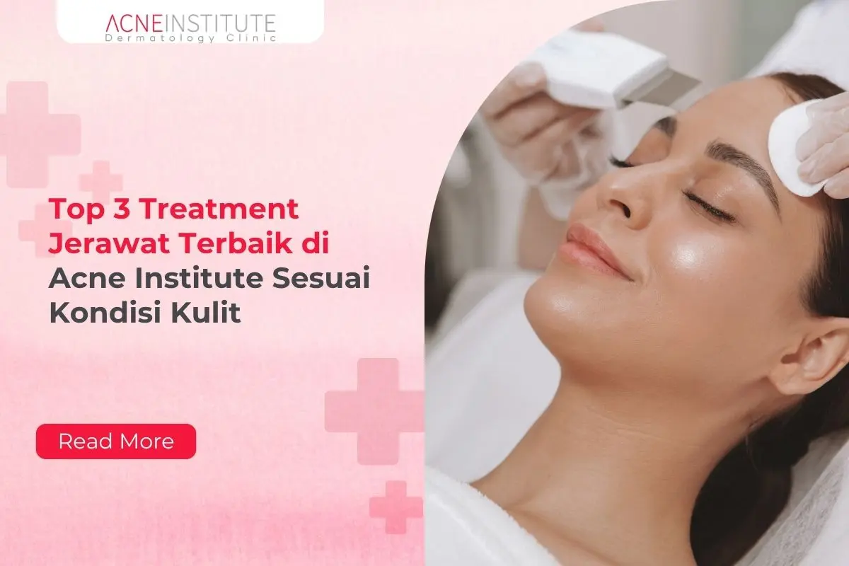 Top 3 Treatment Jerawat Terbaik di Acne Institute Sesuai Kondisi Kulit