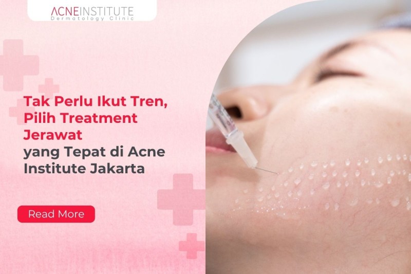 Tak Perlu Ikut Tren, Pilih Treatment Jerawat yang Tepat di Acne Institute Jakarta