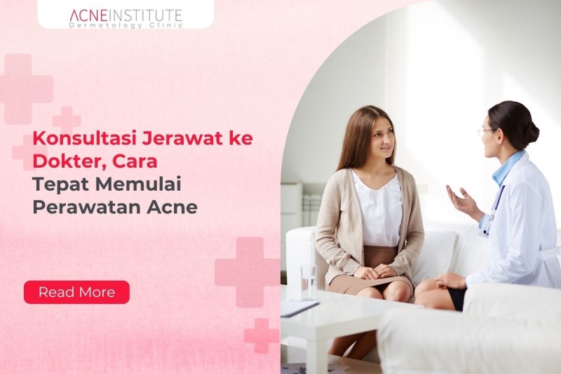 Konsultasi Jerawat ke Dokter, Cara Tepat Memulai Perawatan Acne
