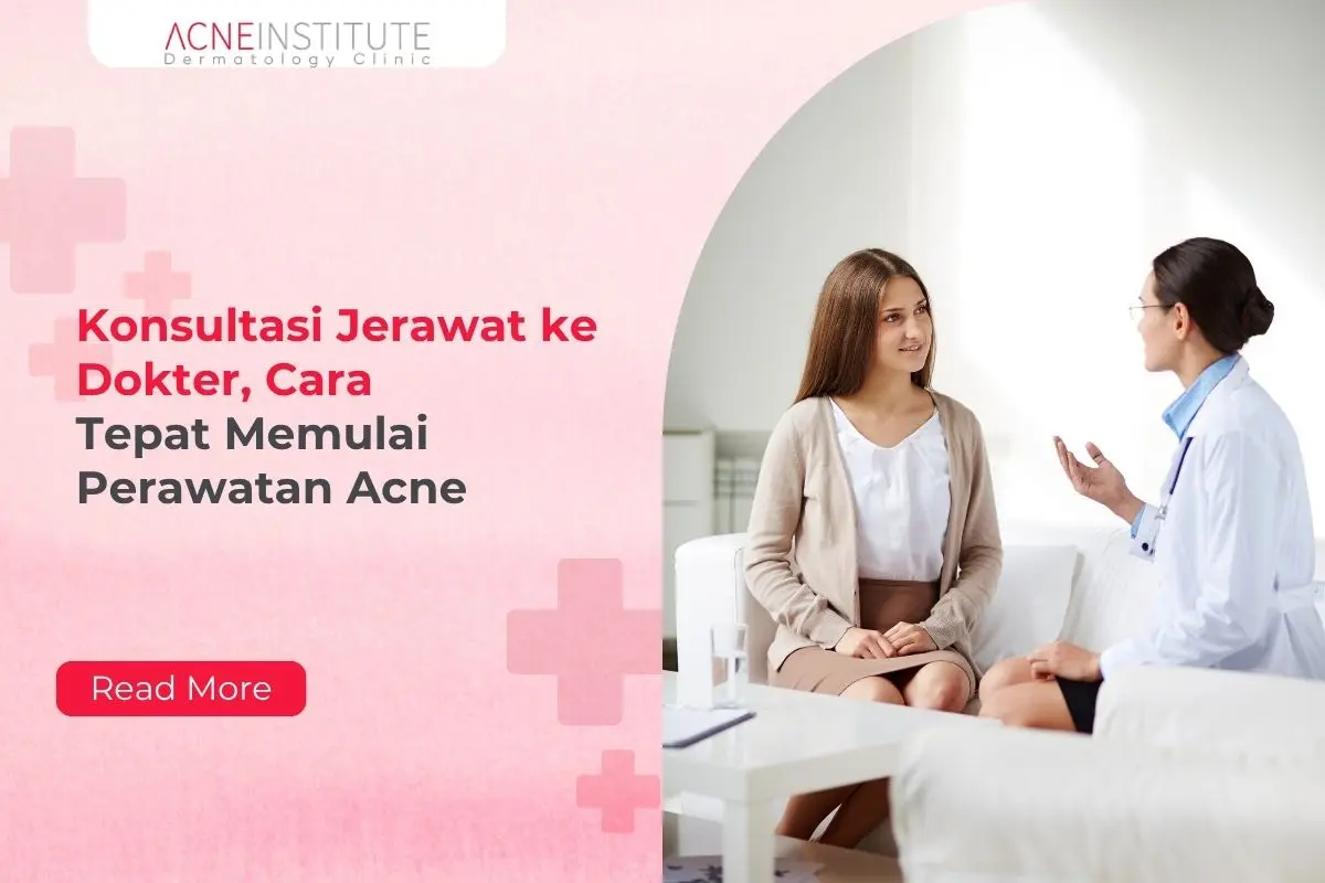 Konsultasi Jerawat ke Dokter, Cara Tepat Memulai Perawatan Acne