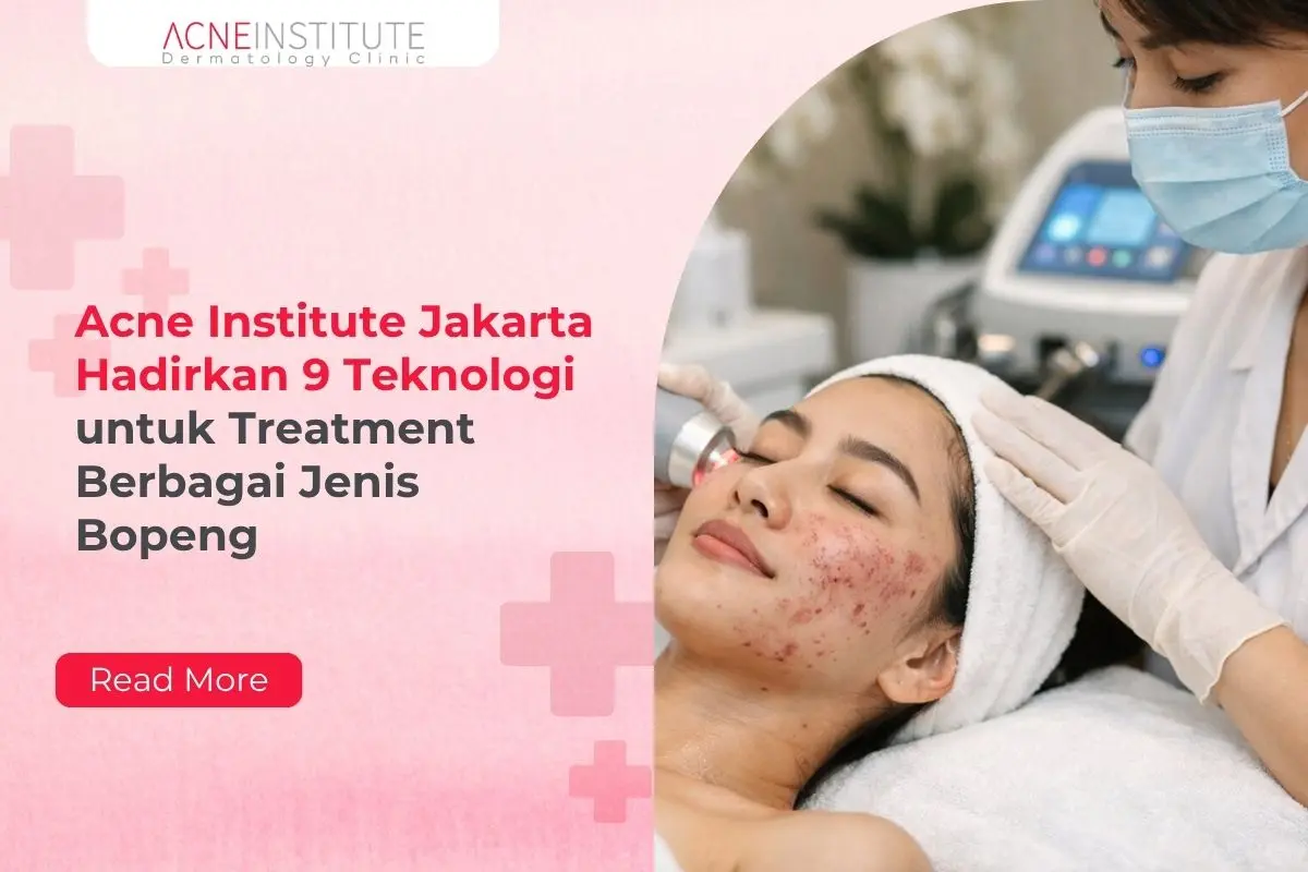 Acne Institute Jakarta Hadirkan 9 Teknologi untuk Treatment Berbagai Jenis Bopeng