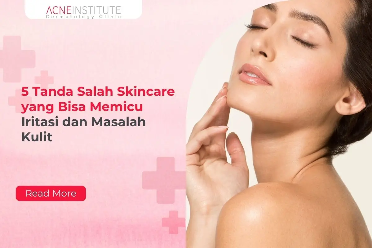 5 Tanda Salah Skincare yang Bisa Memicu Iritasi dan Masalah Kulit