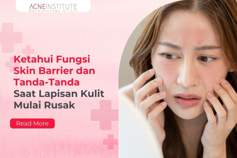 Ketahui Fungsi Skin Barrier dan Tanda-Tanda Saat Lapisan Kulit Mulai Rusak