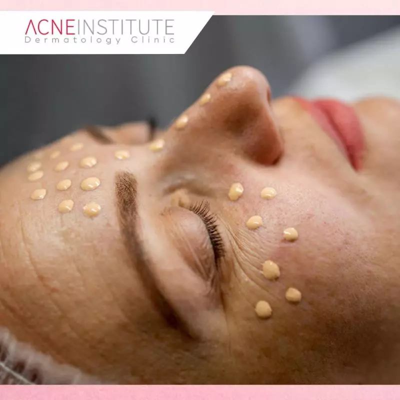 Apakah BB Glow Treatment Aman Dilakukan?