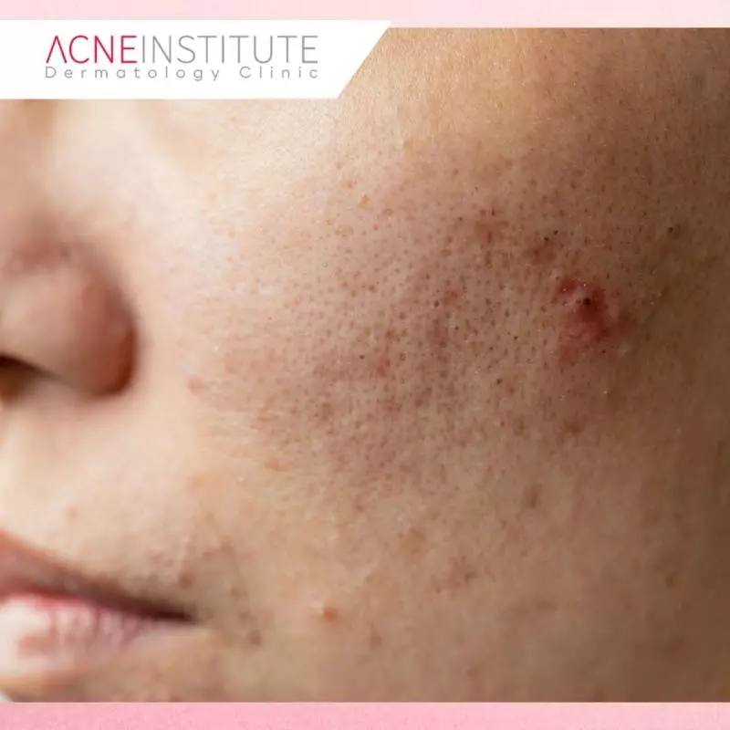 Tanda-Tanda Receptor Fatigue Skincare