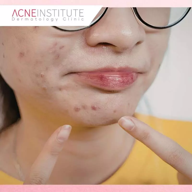 Apa Itu Skin Adaptation