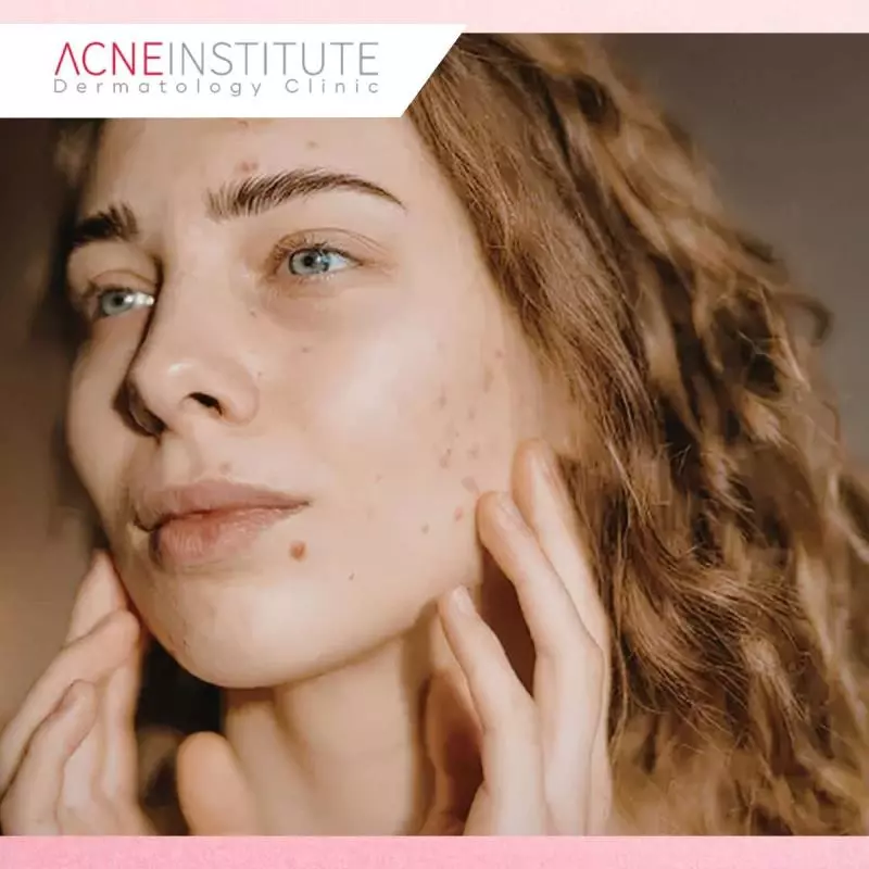 Kesalahan Umum Saat Mengalami Skin Adaptation