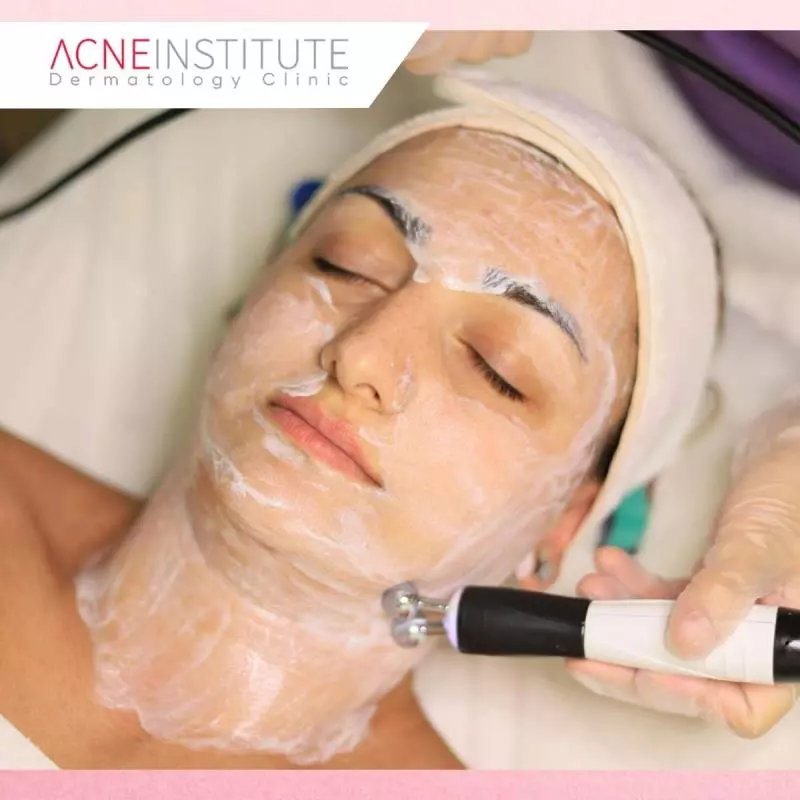 Keunggulan Treatment Acne Non Invasif di Acne Institute Surabaya
