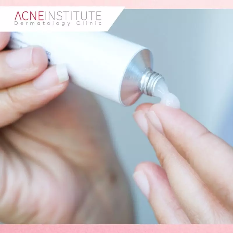 Apa Itu Steroid-Induced Acne?