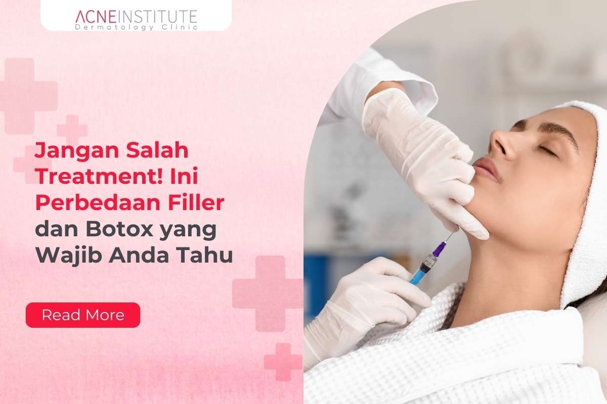 Botox Mahal Ini Jangan Salah Treatment! Ini Perbedaan Filler Dan Botox Yang Wajib Anda Tahu