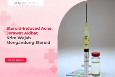 Steroid-Induced Acne, Jerawat Akibat Krim Wajah Mengandung Steroid