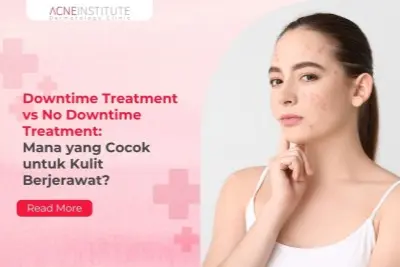 Downtime Treatment vs No Downtime Treatment: Mana yang Cocok untuk Kulit Berjerawat?