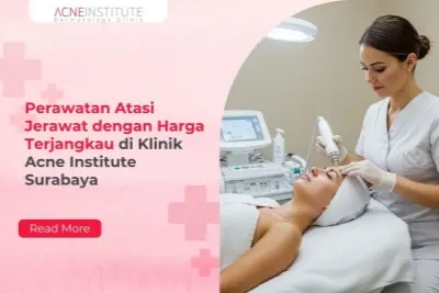 Perawatan Atasi Jerawat dengan Harga Terjangkau di Klinik Acne Institute Surabaya