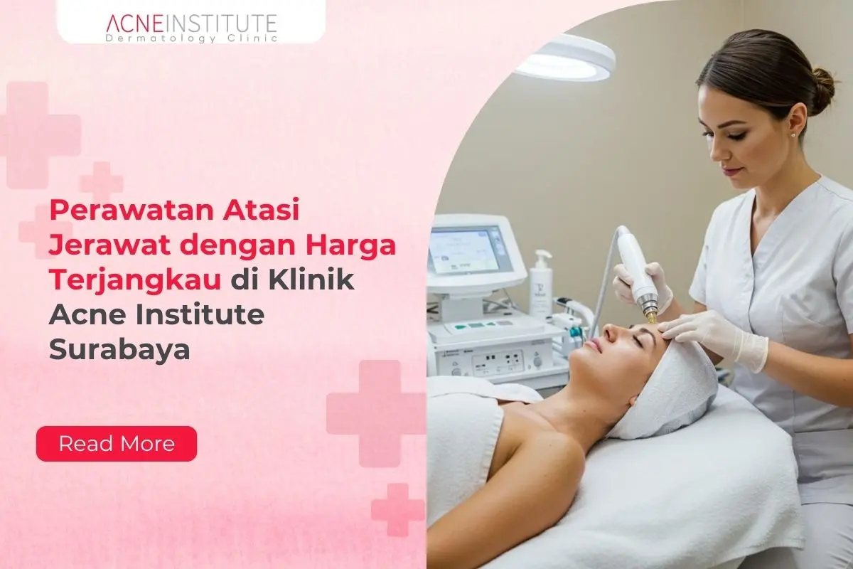 Perawatan Atasi Jerawat dengan Harga Terjangkau di Klinik Acne Institute Surabaya