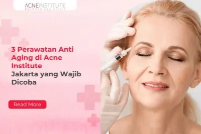 3 Perawatan Anti Aging di Acne Institute Jakarta yang Wajib Dicoba