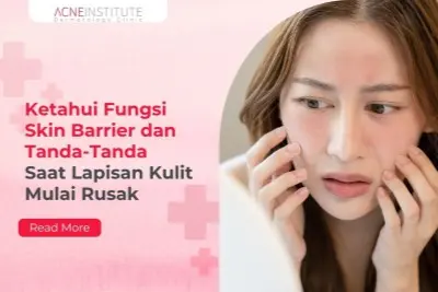 Ketahui Fungsi Skin Barrier dan Tanda-Tanda Saat Lapisan Kulit Mulai Rusak