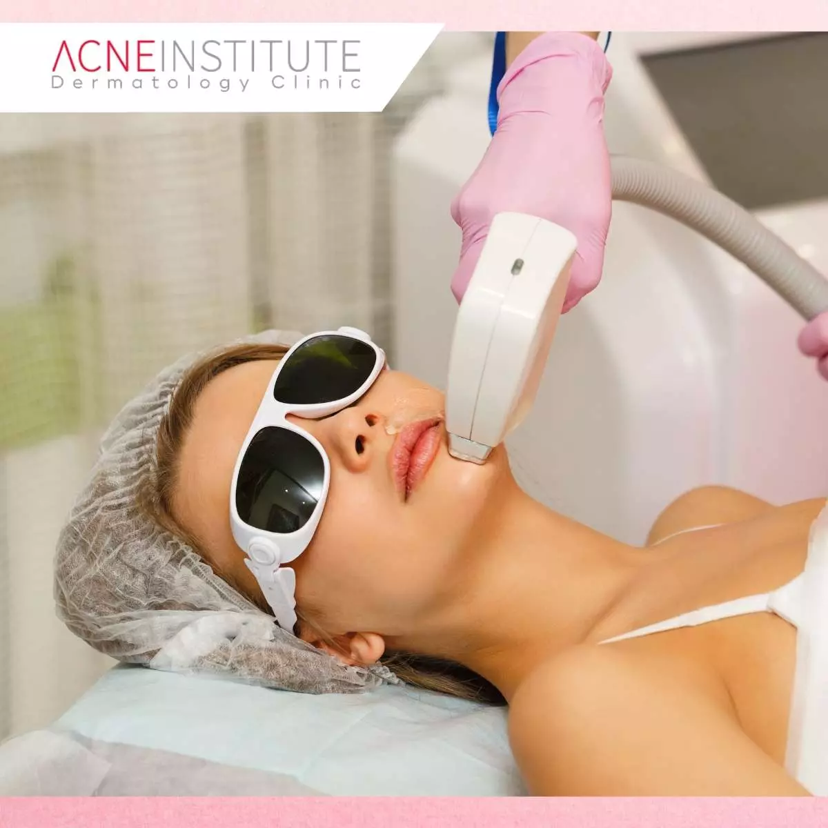 Fiber Laser Treatment di Acne Institute Jakarta
