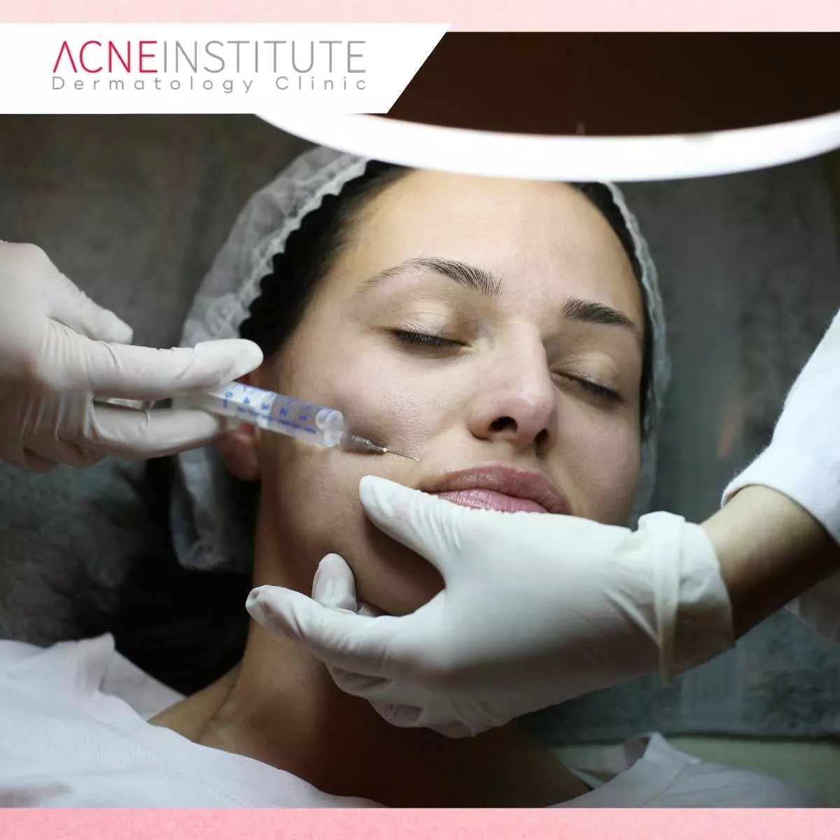 Prosedur Botox Wajah