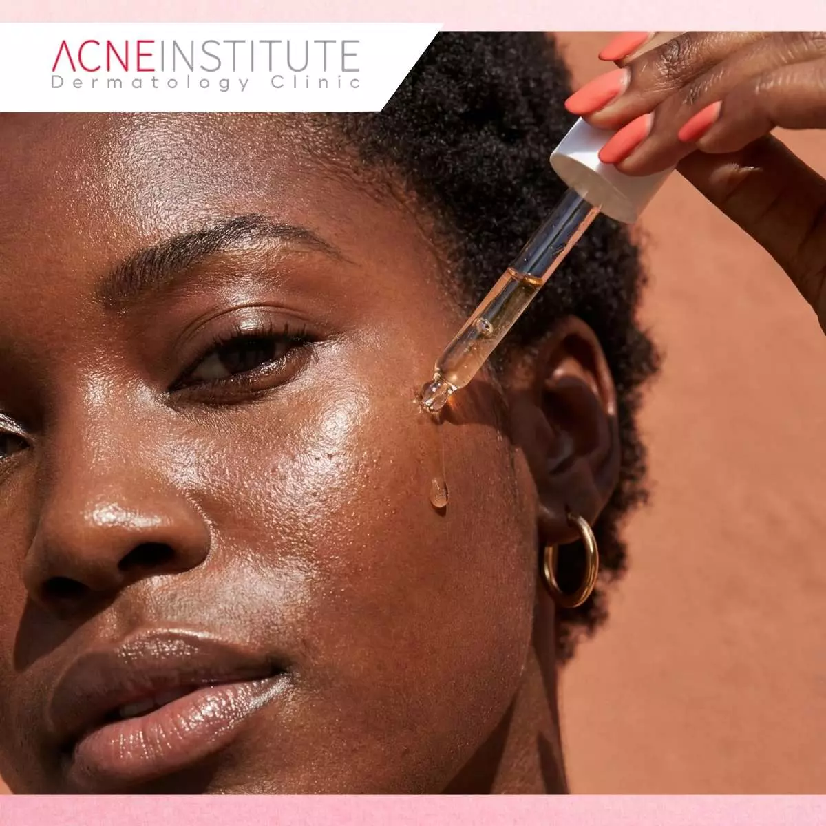 Rutinitas Skincare untuk Kulit Kering Berjerawat