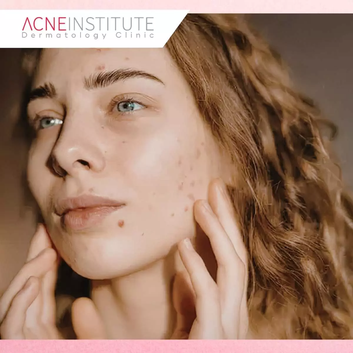 Kesalahan Umum Saat Mengalami Skin Adaptation