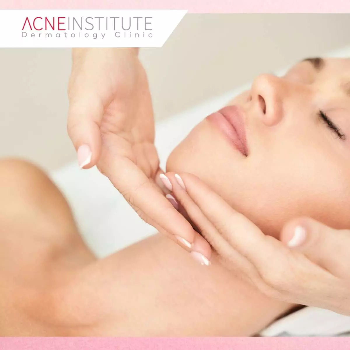 Treatment N Beam untuk Atasi Bekas Jerawat Hitam