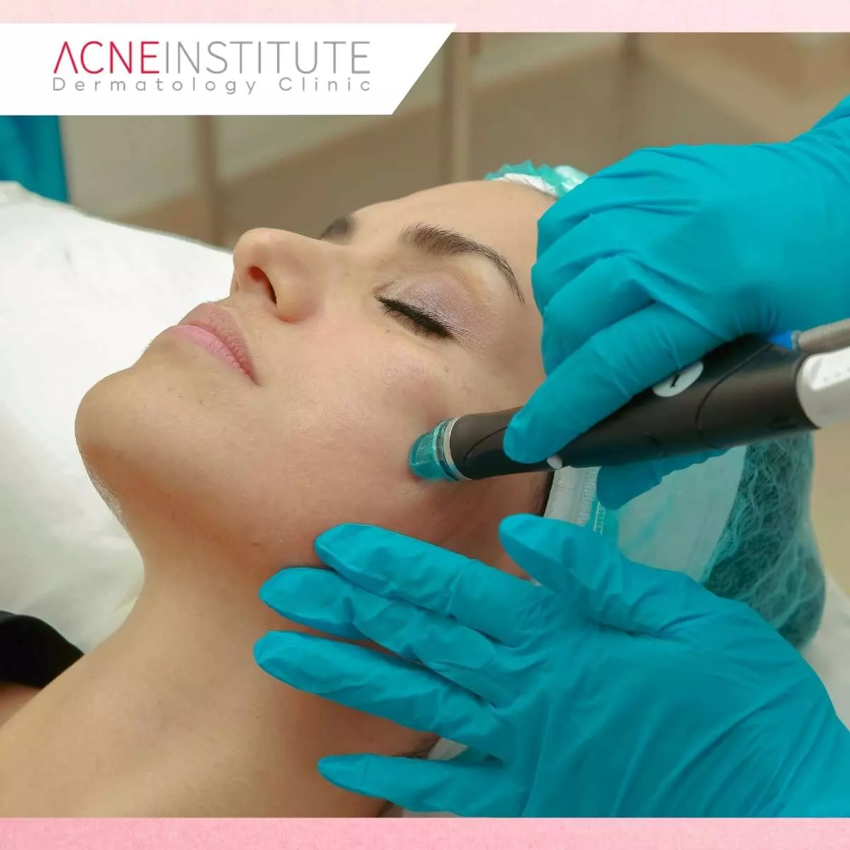 Bagaimana Cara Kerja Magic Pore Treatment?