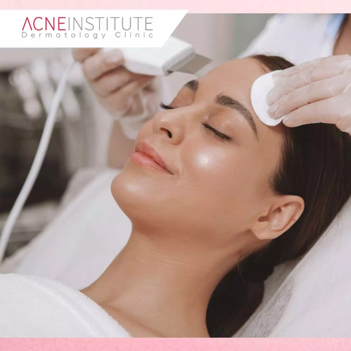 Apa Itu Treatment Scarfill?