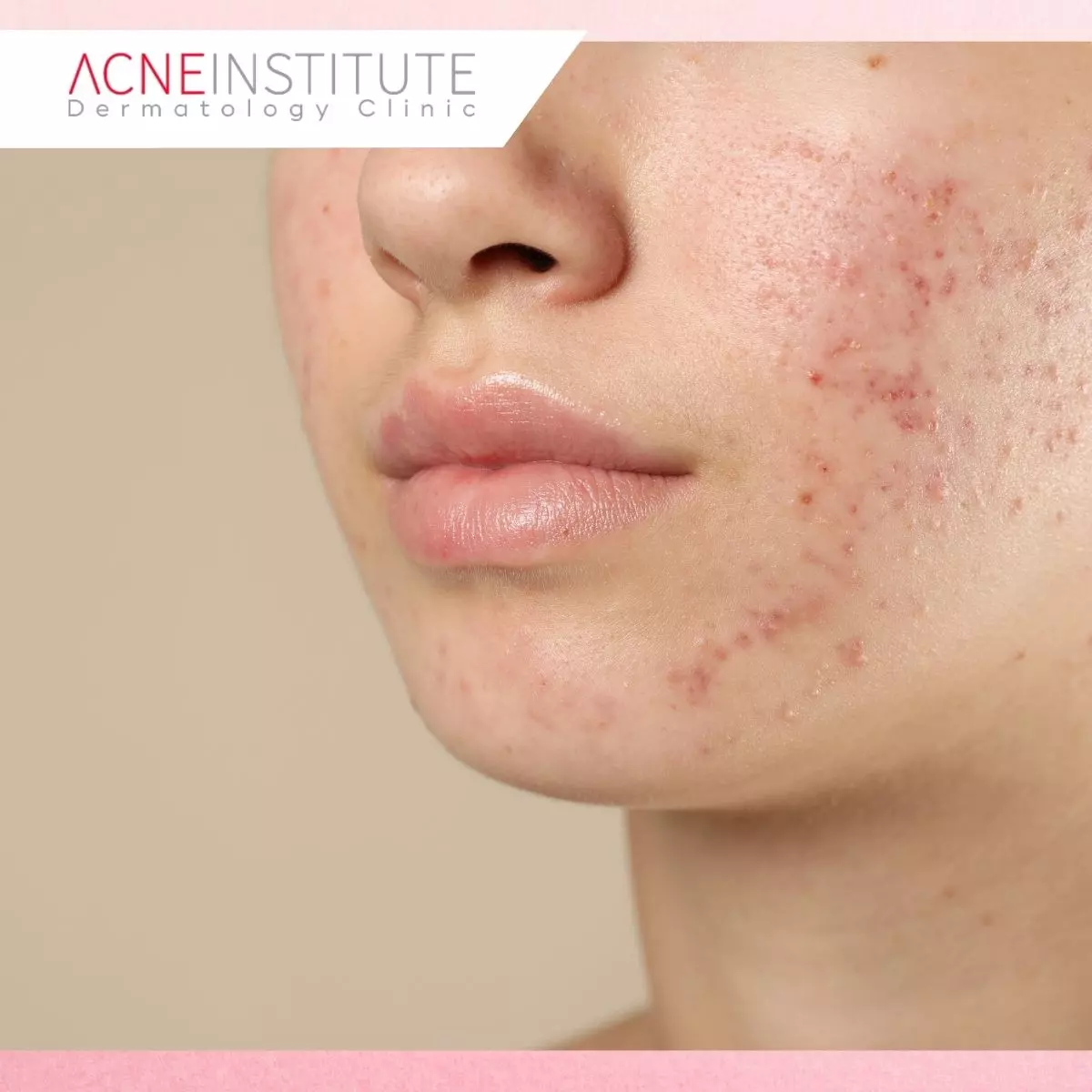Mengapa Satu Treatment Saja Belum Tentu Cukup?