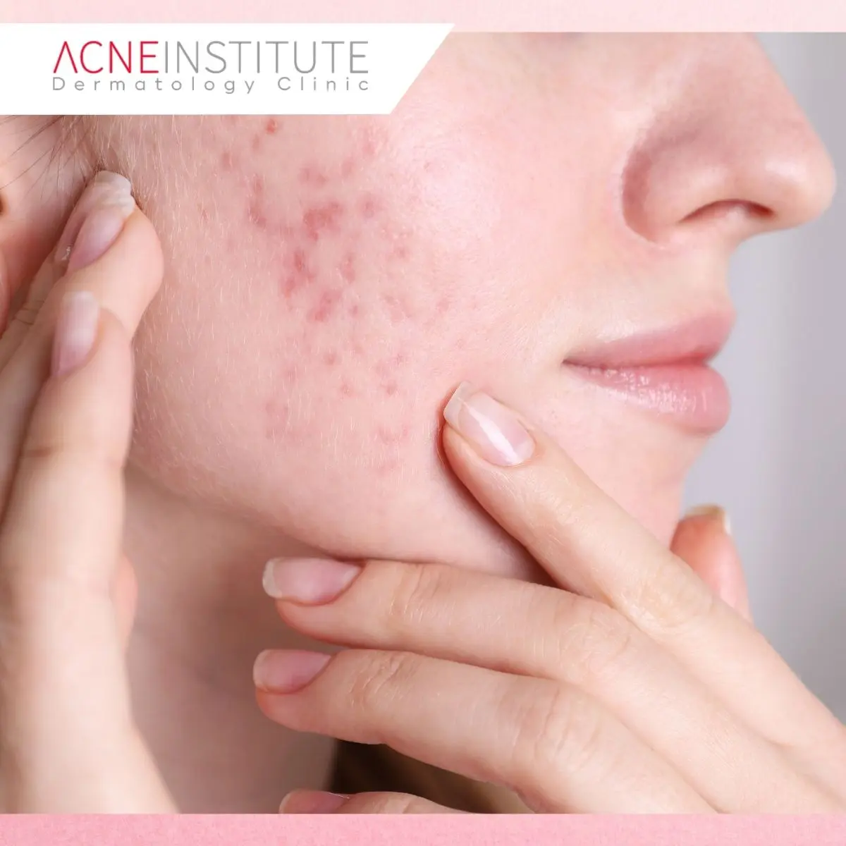 Apakah Ketiga Treatment Bisa Dikombinasikan?
