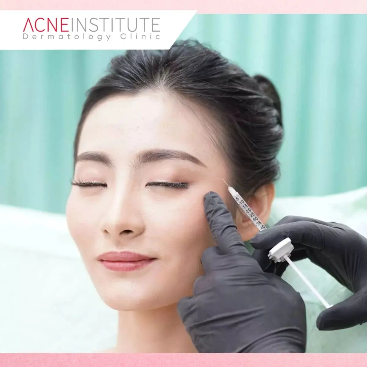 Mengenal Acne Institute Jakarta