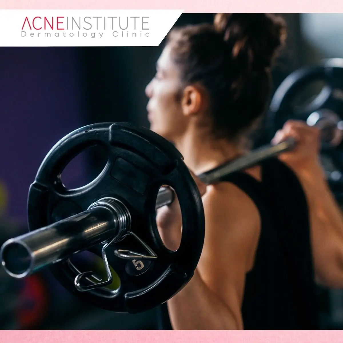 Kenapa Jerawat Punggung Sering Muncul Setelah Gym?