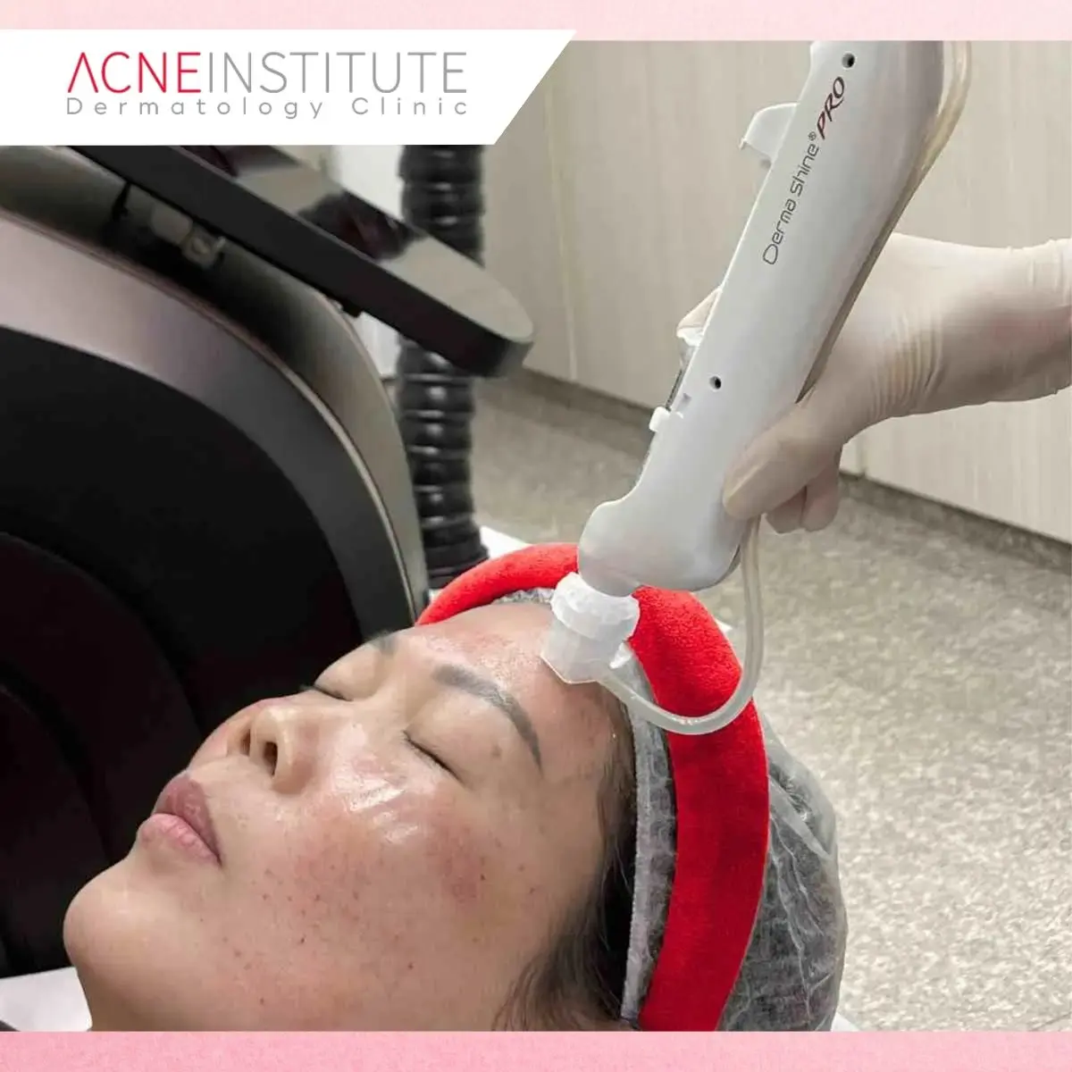 Kapan Sebaiknya Mulai Treatment Anti Aging?