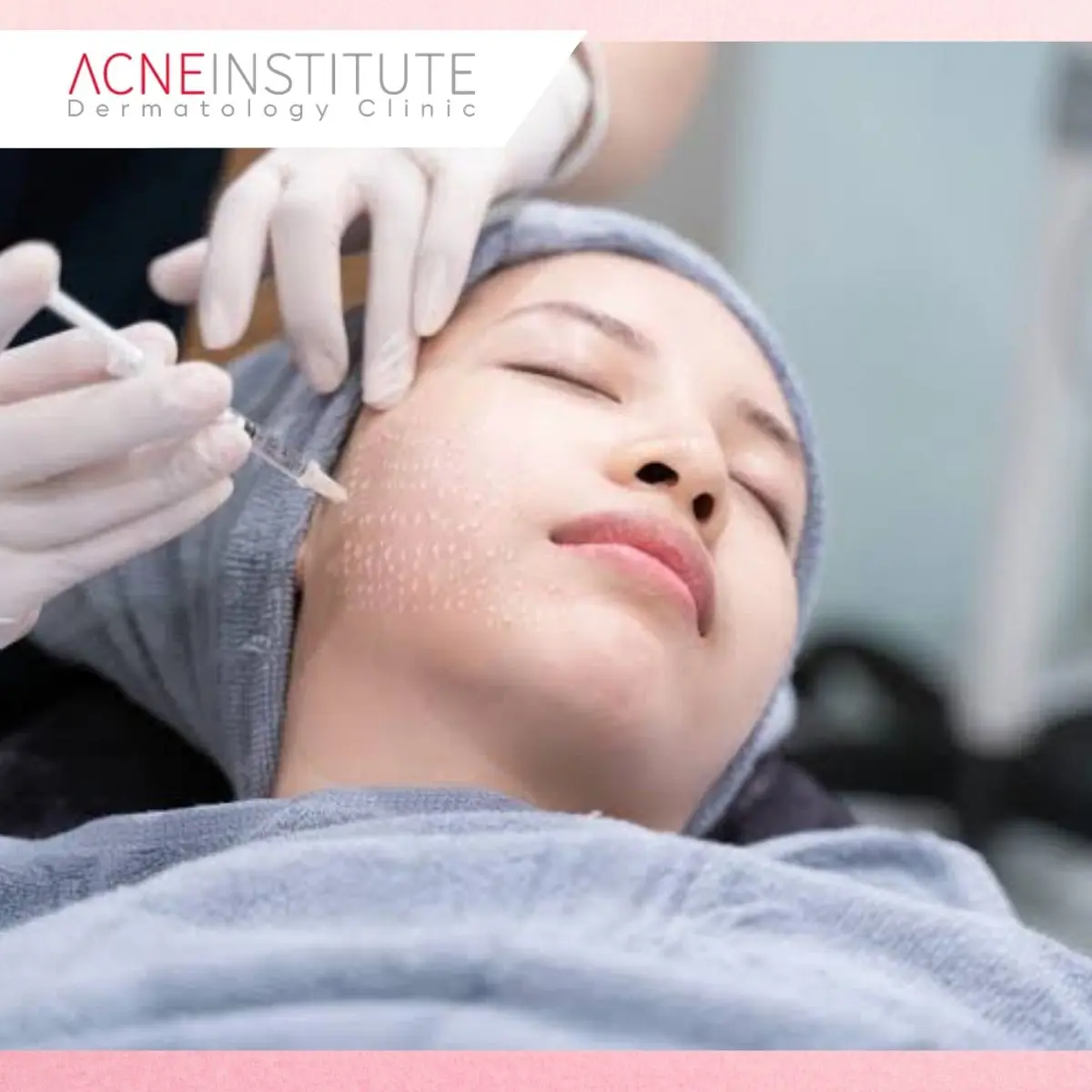 2. Skin Booster